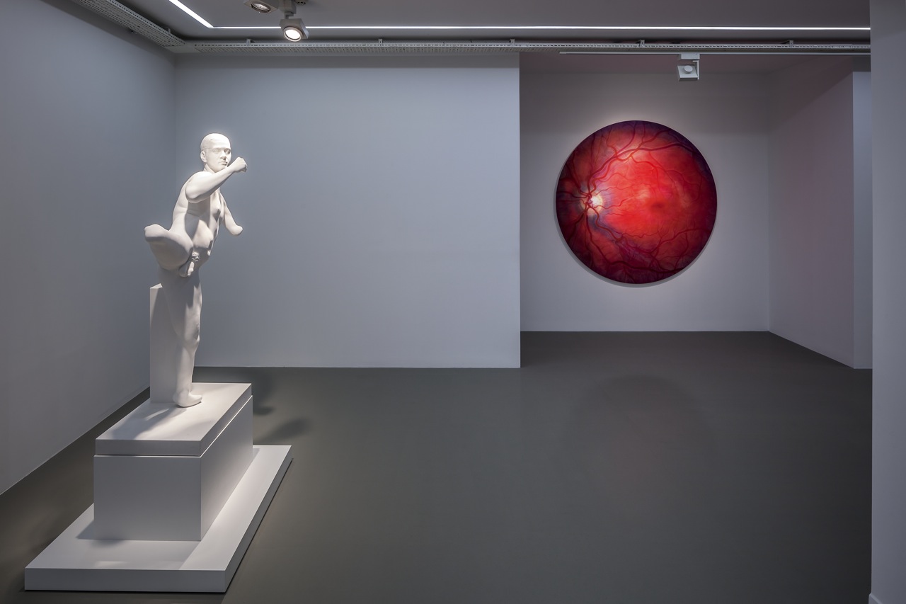 The Sleep of Reason (Aklın Uykusu)